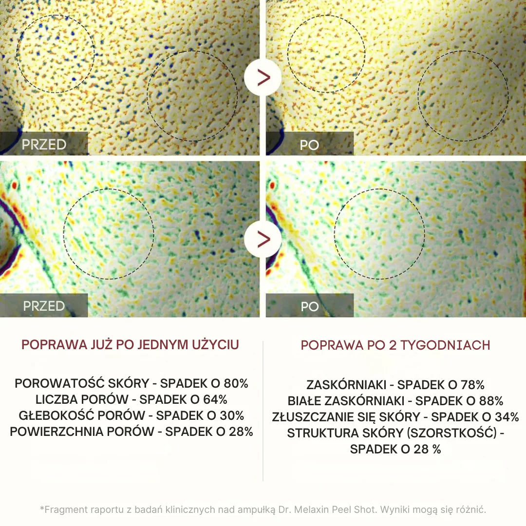 Dr Melaxin Peel Shot Ampoule